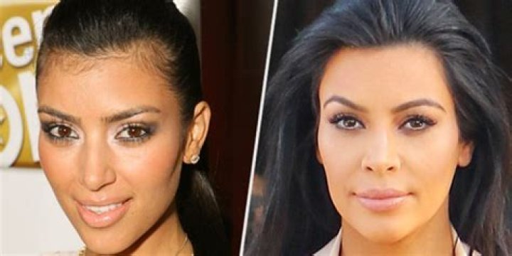 'I Had Such a Hairy Neck' |