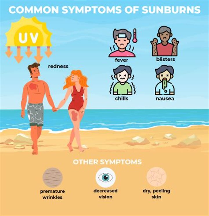 A woman's horrific sunburn is teaching people about sun poisoning and serving as an essential PSA to