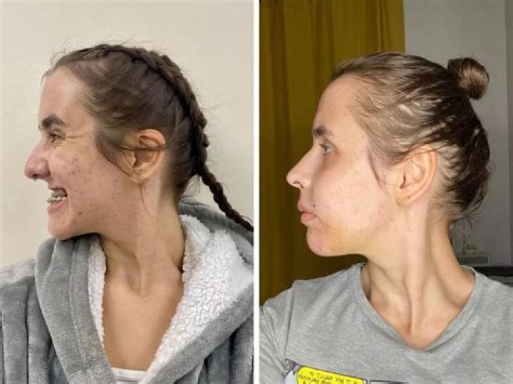 Before And After Surgery Insights Revealed