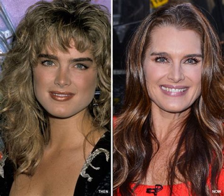 Brooke Shields' Before And After Journey