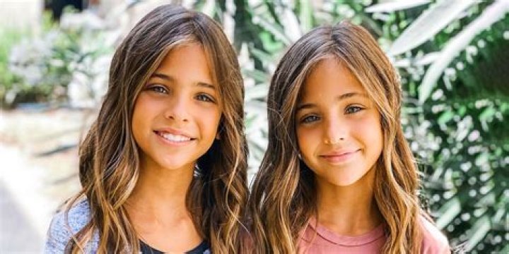 Check Out The Beautiful Twin Sisters That Were Cut Into Two Through Surgery (PHOTOS)