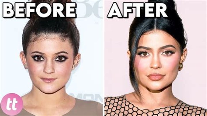 How To Find Celebrity Before And After Transformation Pics