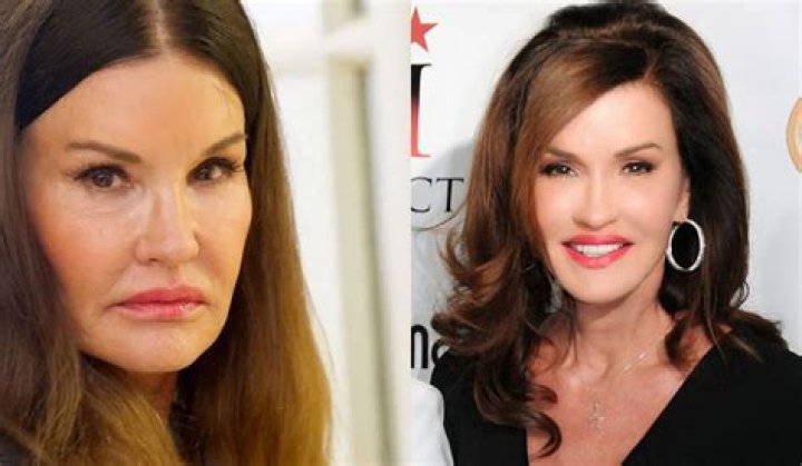 Janice Dickinson Before Surgery, Young, Breast Cancer, Kids, Drugs, Fiance, Husband, Spouse, Net Worth ·