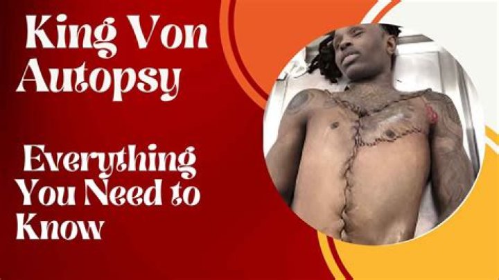 King Von's Autopsy Image Unveiled