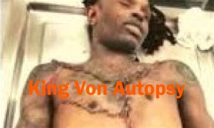 King Von Autopsy Photos Revealed
