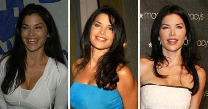 Lauren Sanchez Before Surgery Did She Underwent Plastic Surgery?