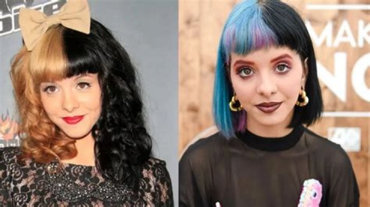 Melanie Martinez's Plastic Surgery Journey Revealed