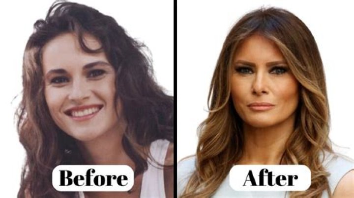 Sarah Palin Plastic Surgery Did She or Didn't She? Hollywood Life ·