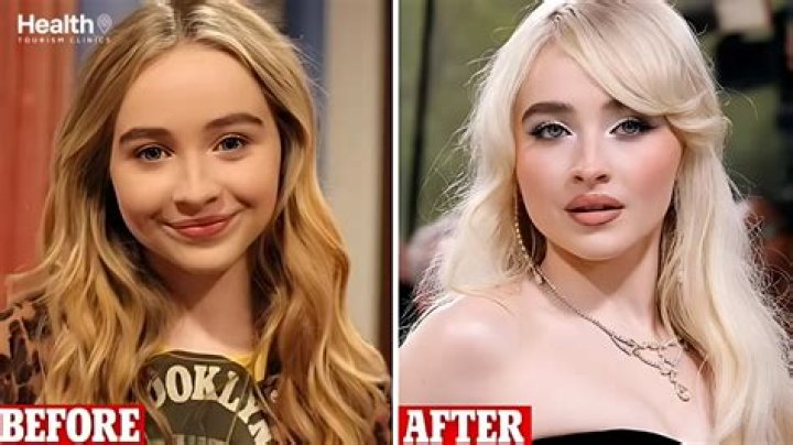 The Truth About Sabrina Carpenter's Plastic Surgery Transformation