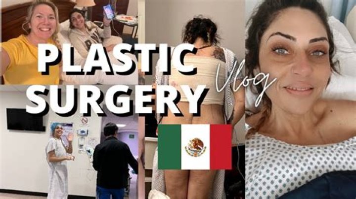 Unbiased Plastic Surgery Reviews From Mexico