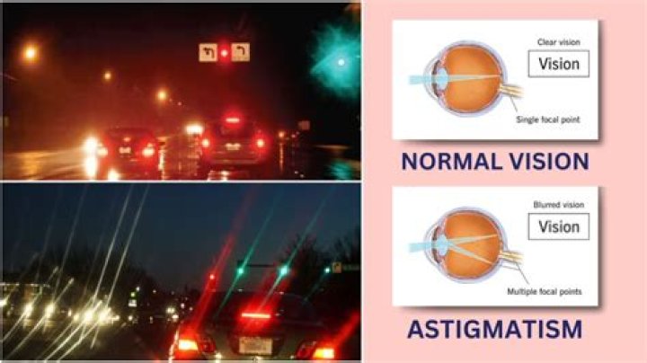 Unveil The Hidden World Of Astigmatism: Clarity And Insights Revealed