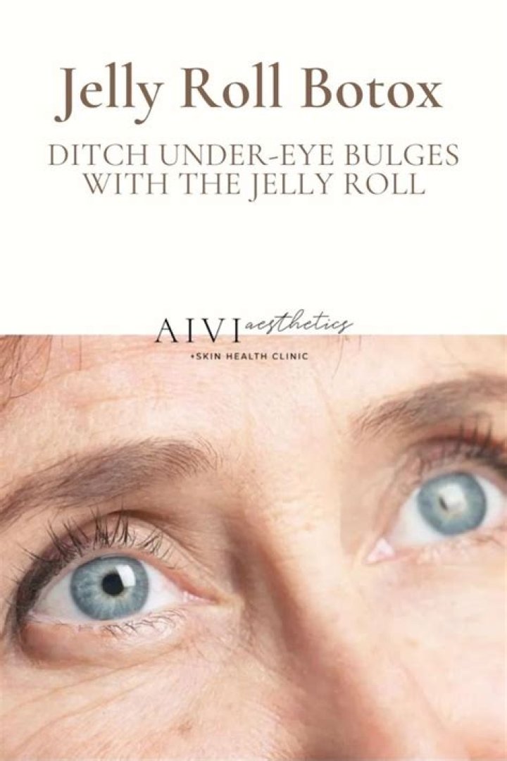 Unveil The Secrets Of Jelly Roll Botox: Before And After Insights