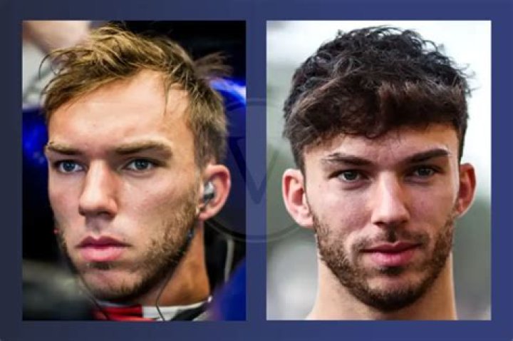 Unveiling Pierre Gasly's Hair Loss: Insights And Revelations
