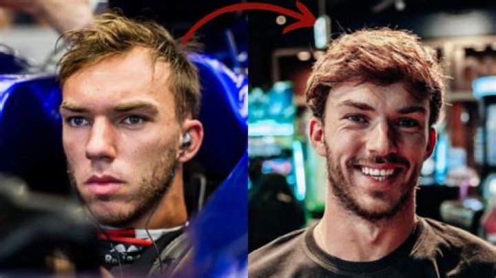 Unveiling The Enigma Of Gasly Bald: Unraveling Causes And Cures