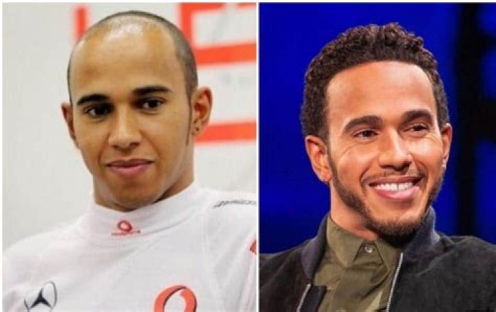 Unveiling The Enigma Of Gasly Hair: Discoveries And Insights