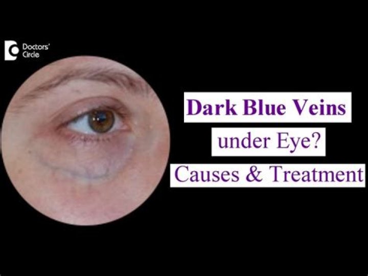 Unveiling The Secrets Of Meme Veins: Discoveries And Insights