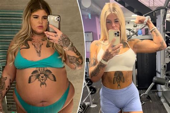Weight Loss And Plastic Surgery Revealed