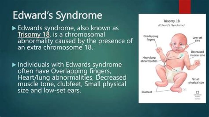 What's Mackenzie Edwards Known For?