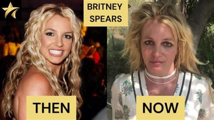What Happened To Britney Spears' Teeth: A Journey Of Transformation