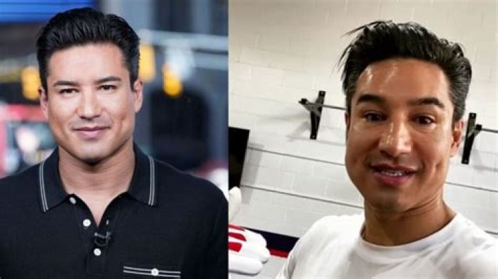 What Health Issue Does Mario Lopez Have