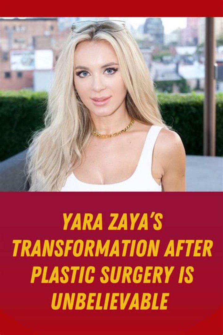 Yara Zaya's Plastic Surgery Journey On 90 Day Fiance: A Comprehensive Guide